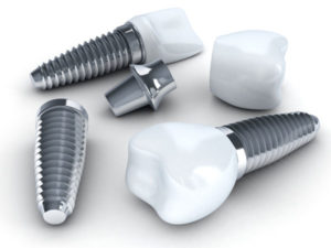 Different parts of Dental Implants in Smithtown, NY