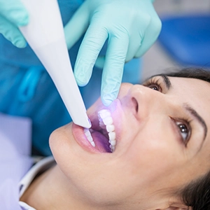 teeth whitening treatment of a patient